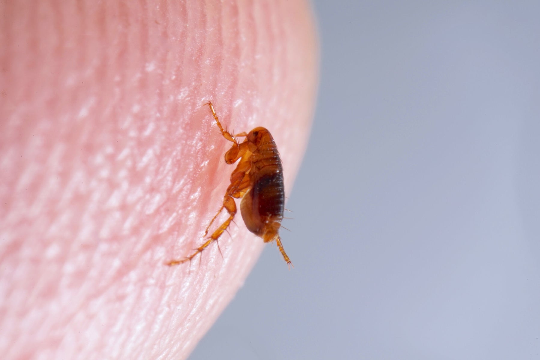 Combattre les puces sur les humains : conseils et astuces efficaces 