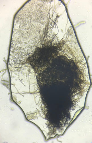 Chaetomium globosum — Bild 4