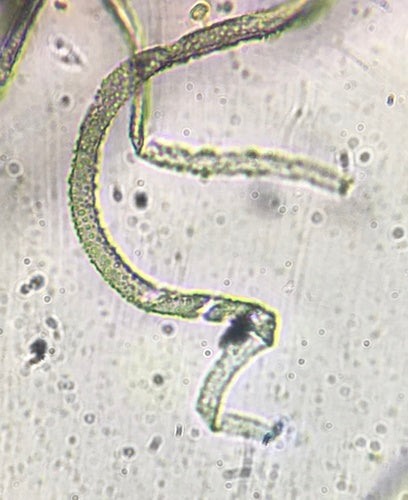 Chaetomium globosum — Bild 5