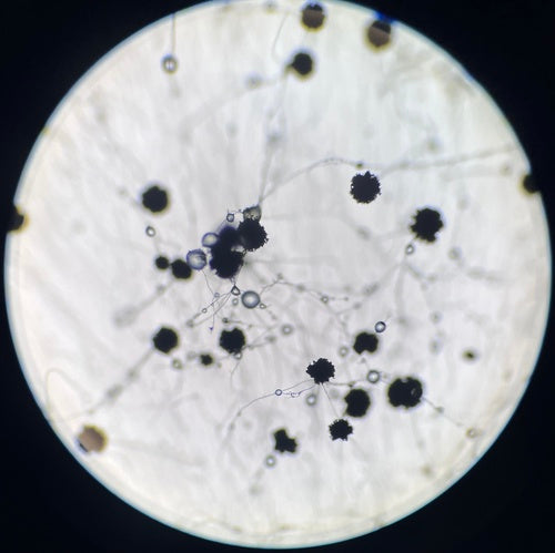 Gießkannenschimmel - Bild 5