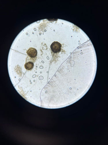 Gießkannenschimmel - Bild 1