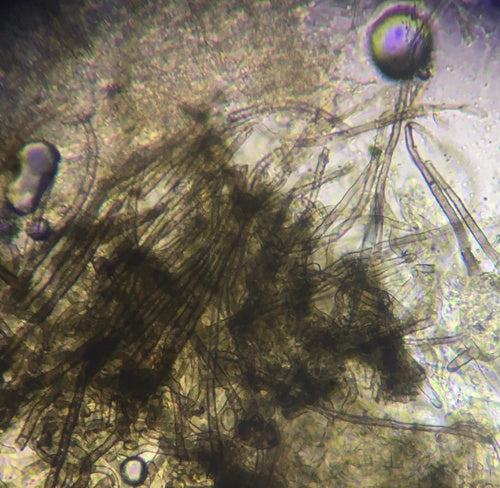 Chaetomium globosum — photo 5 sur 21