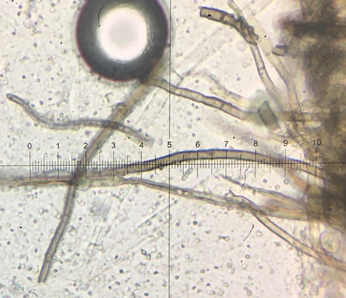 Chaetomium globosum — photo 3 sur 21