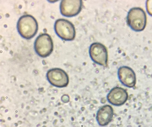 Chaetomium globosum — photo 2 sur 21