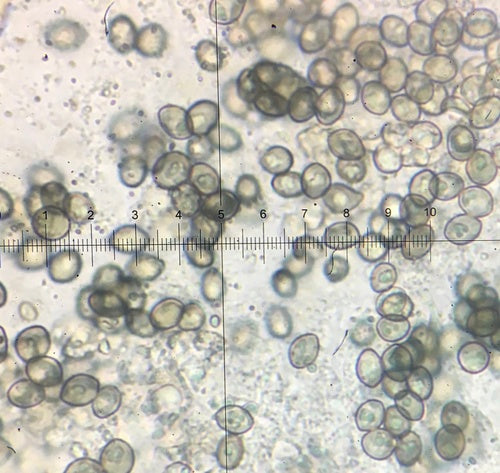 Chaetomium globosum — photo 4 sur 21