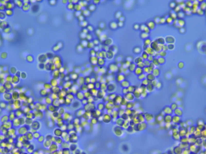 Mucor (moisissure de la tête) — photo 2 sur 2