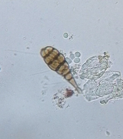 Alternaria — photo 5 sur 8