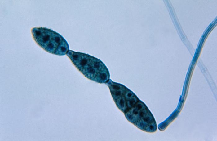Alternaria — photo 2 sur 8