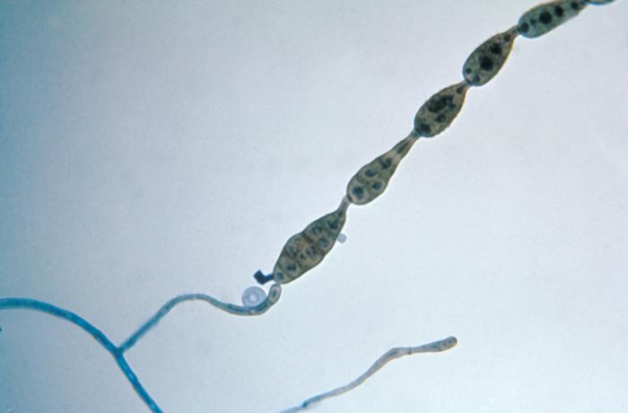 Alternaria — photo 3 sur 8