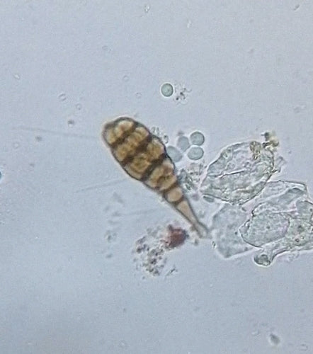 Ulocladium — Bild 2